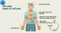 RỐI LOẠN DẠNG CƠ THỂ (F45): BỆNH CÓ THẬT – CẦN HIỂU ĐÚNG, KHÁM ĐÚNG